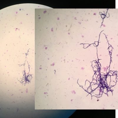 Actinobacteria-em-microscopia