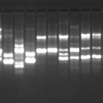 Diferenciação de cepas bacterianas por análise genética de BOX-PCR