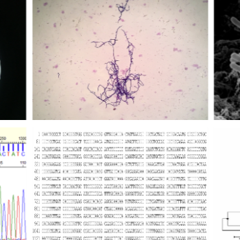 Microscopia, sequenciamento genético e análise filogenética